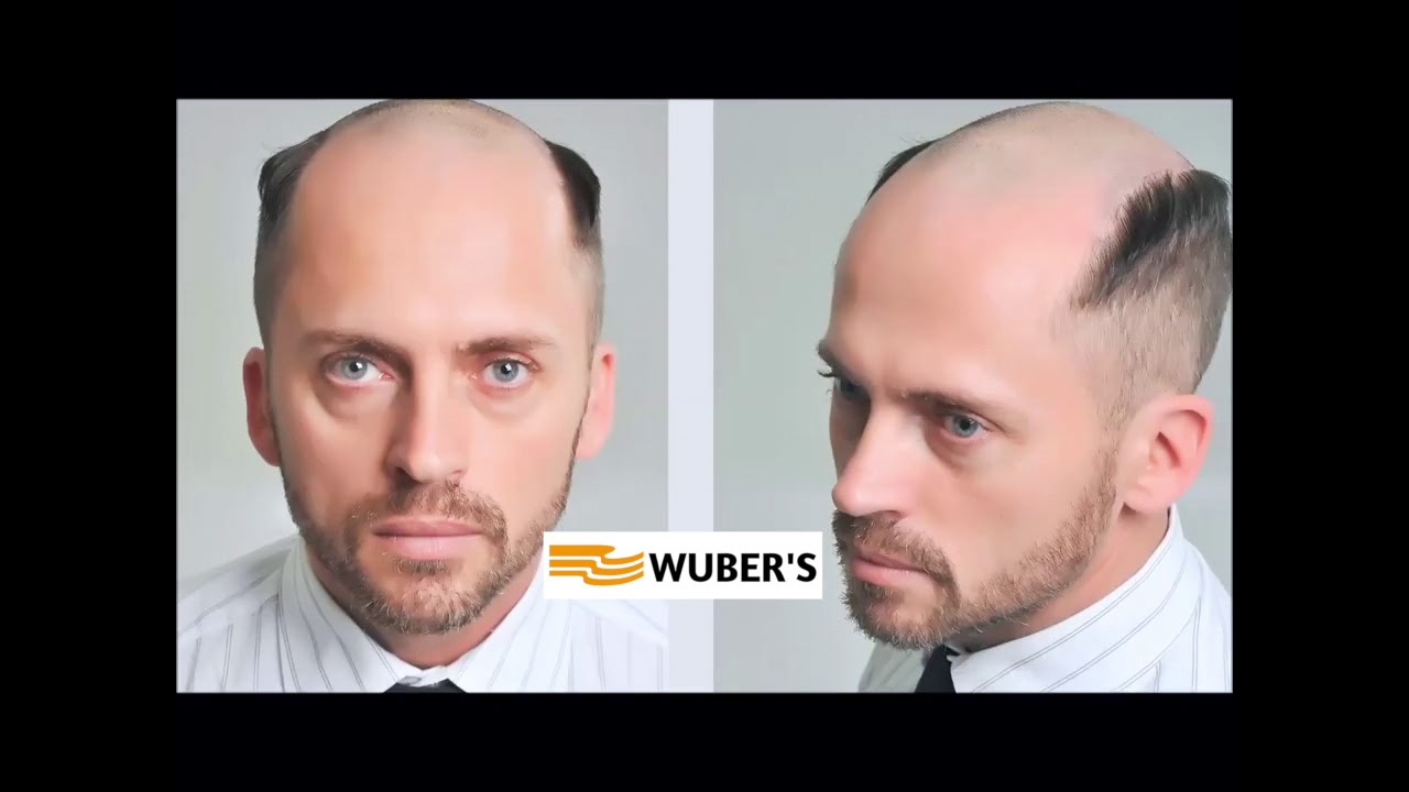 Roma Protesi Capelli 299 00 Euro Impianto Capelli Infoltimento Wuber s 