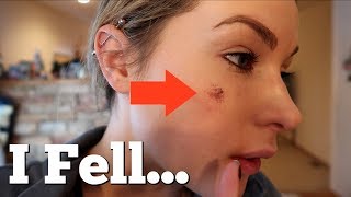 I fell On My Face... - Pranksters in Love Vlog