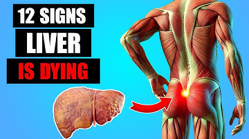 12 STRANGE Signs Your Liver Is Crying for Help – Don