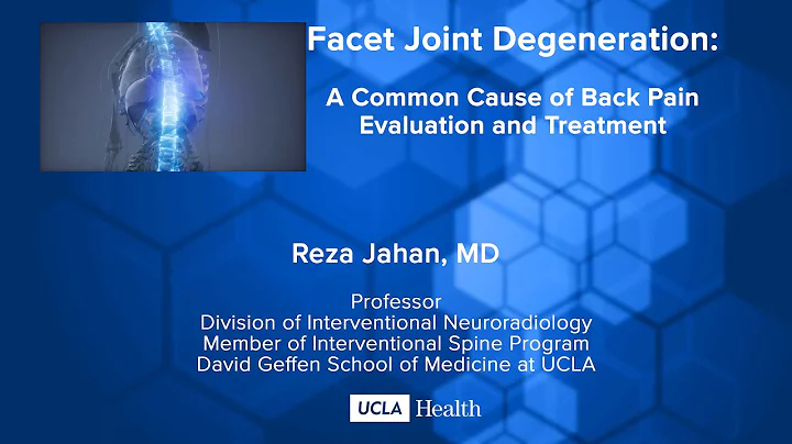 Facet Joint Degeneration: A Common Cause of Back Pain Evaluation and Treatment