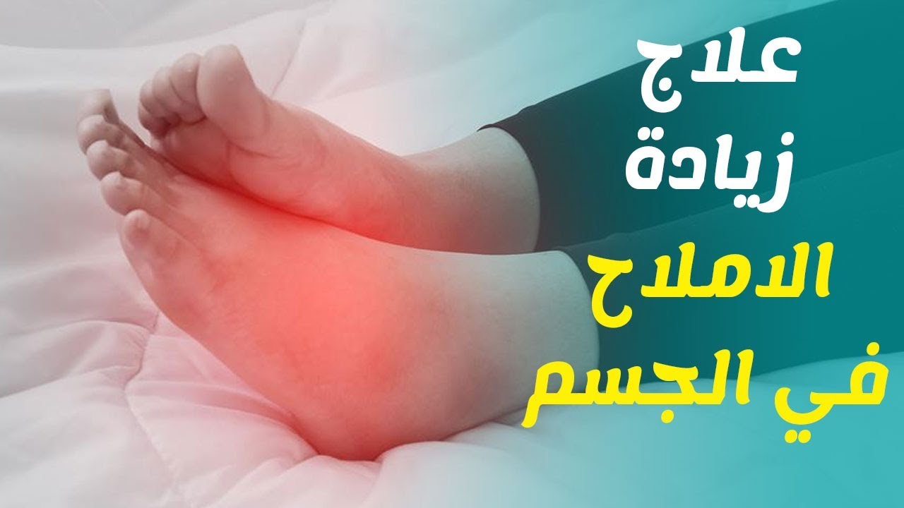 علاج زيادة الأملاح في الجسم