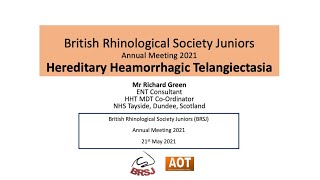 Rhinology Hereditary Heamorrhagic Telangiectasia Brsj Mr Richard Green
