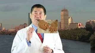 Gout | allopurinol cuts death risk