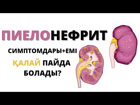 Бейне: Пиелонефриттің негізгі себептері қандай?