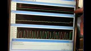 Test Your Lean P0171 / P0174 Diagnostic Skills-Pt7