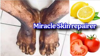 These two ingredients alone can repair damaged skin, yet few people know it. screenshot 1