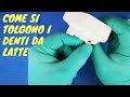 Come si tolgono i denti da latte? Istruzioni passo passo