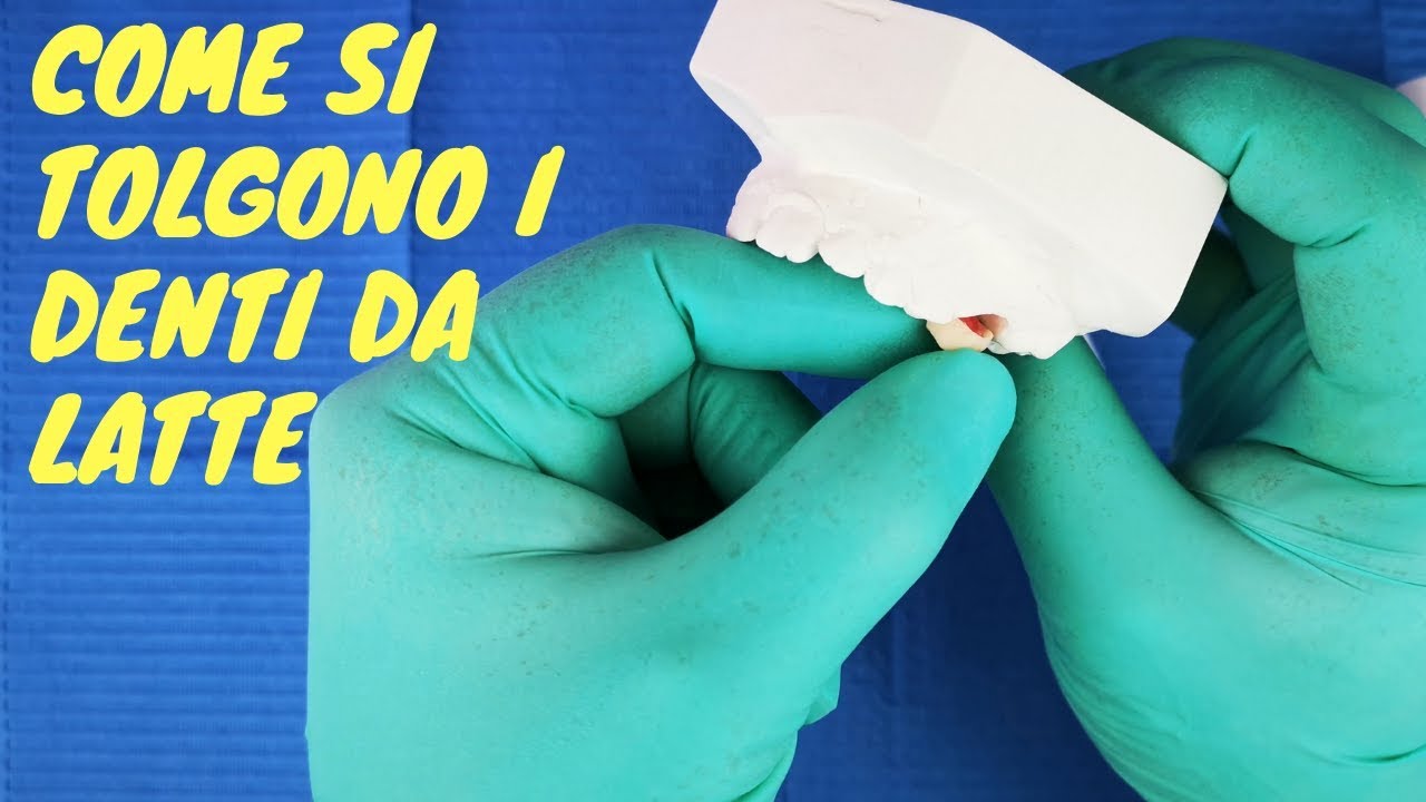 Come si tolgono i denti da latte? Istruzioni passo passo