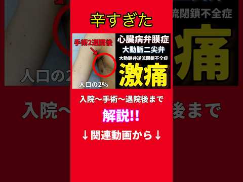 【リアル】【体験談】入院〜手術〜退院までを完全解説!!大動脈二尖弁の方へ。 - NEWS解説良い情報発信