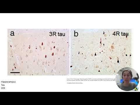 Neuropathology - Part