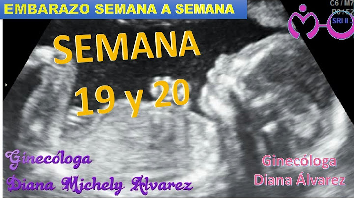 EMBARAZO SEMANA A SEMANA, SEMANA 19 Y 20, POR GINECOLOGA DIANA ALVAREZ