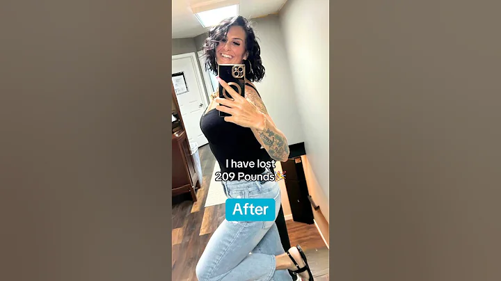 I LOST 200 LBS! Gastric Sleeve 🎉