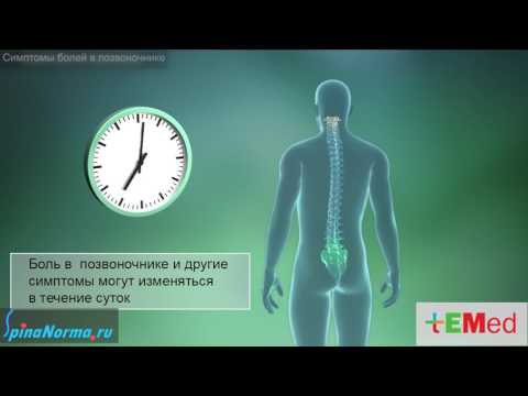 Симптомы болей в позвоночнике