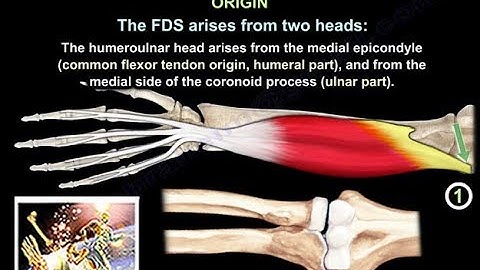 Flexor Digitorum Superficialis - Everything You Need To Know - Dr. Nabil Ebraheim
