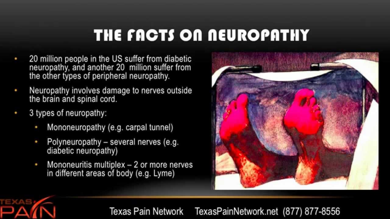 Peripheral & Diabetic Neuropathy Explained by a San