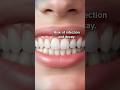 NEVER SHARE A TOOTH BRUSH!!!HERES WHY