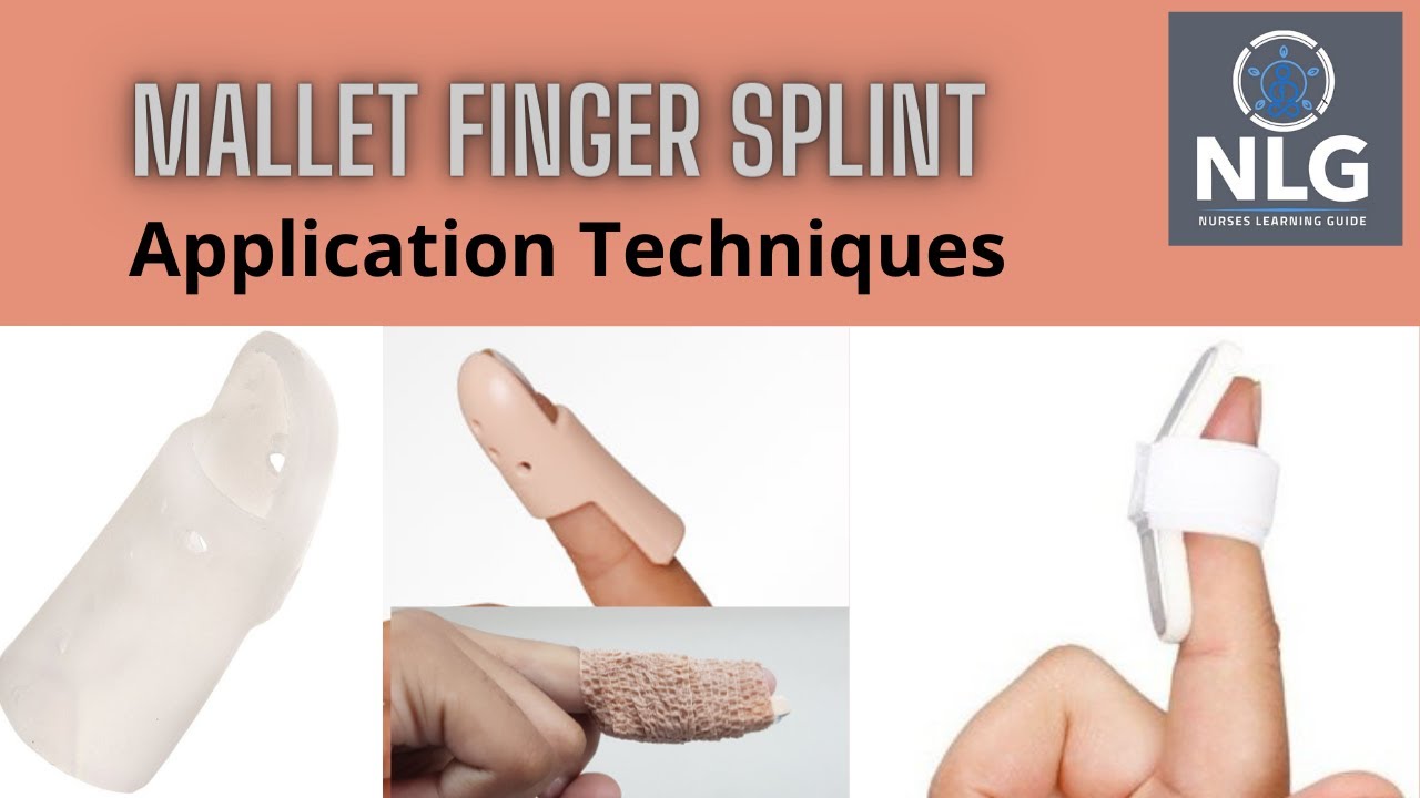 Mallet finger splint application//easy application technique YouTube