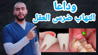 التهاب ضرس العقل وعلاجه | اعراض التهاب ضرس العقل