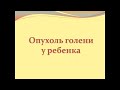 Монофазная (веретеноклеточная) синовиальная саркома мягких тканей правой голени у ребенка.