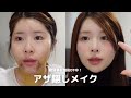 美容整形のダウンタイムに使える最強アザ隠しメイク‼️をしながら整形マイルールを語る