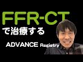 【虚血】FFR CT-based ストラテジー 1年予後 [ADVANCE Registry]