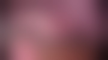 Lap Gastric GIST Surgery