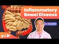 Inflammatory bowel disease ibd  the gutdr explains 3d gut animation