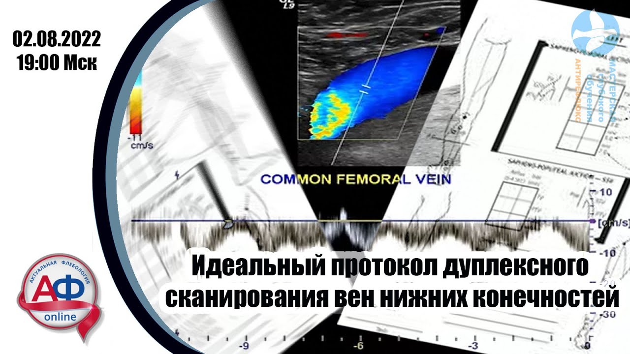 Идеальный протокол дуплексного сканирования вен нижних конечностей ...