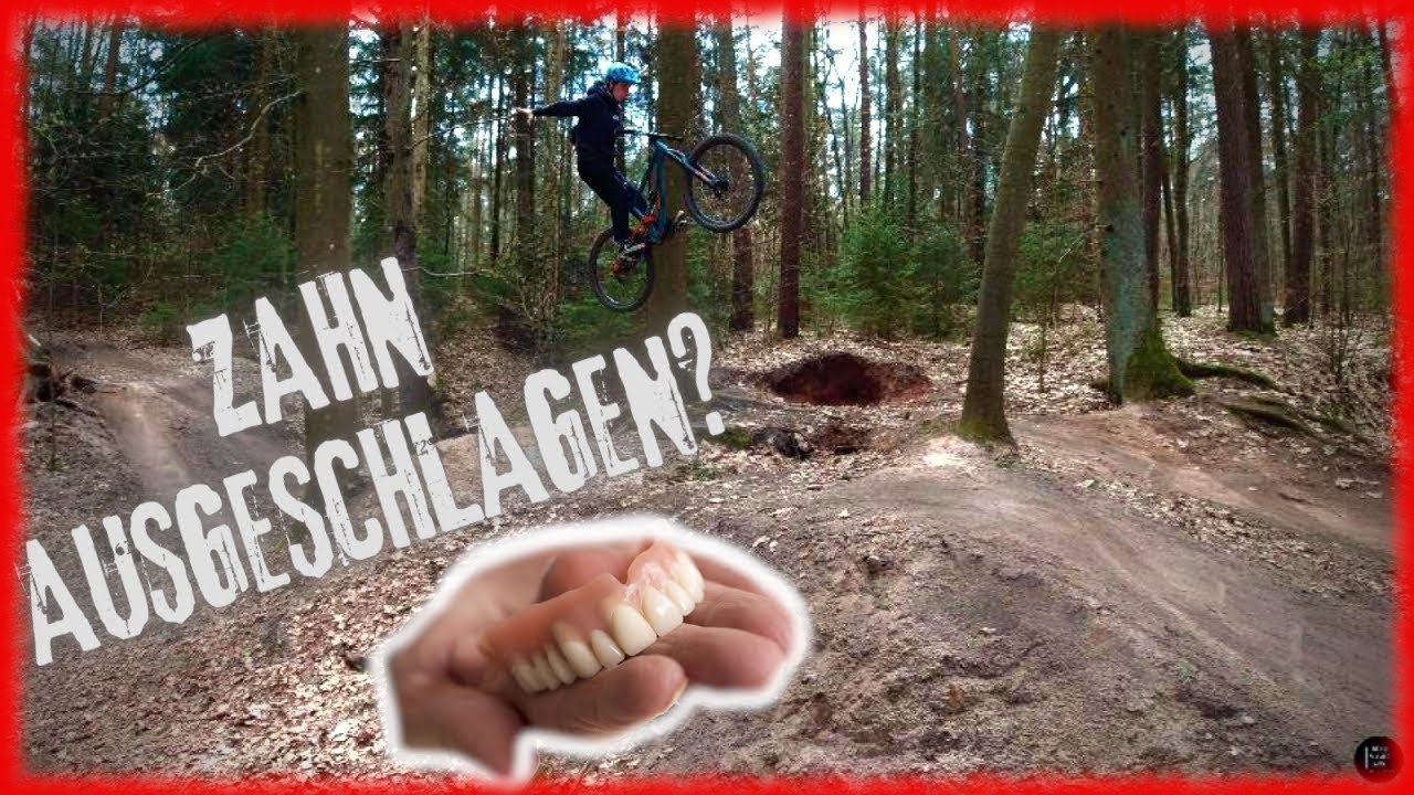 BÖSER MTB CRASH ! Schmausenbuck Mountainbike Trails - BIKE VLOG