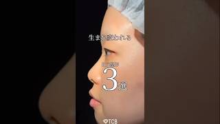 【二重整形】生まれ変わるっ！？#shorts