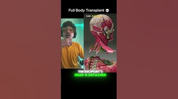 Thumbnail of When you need a Full Body Transplant 💀 #body #transplant #surgeryday #ytviral #viral #shorts