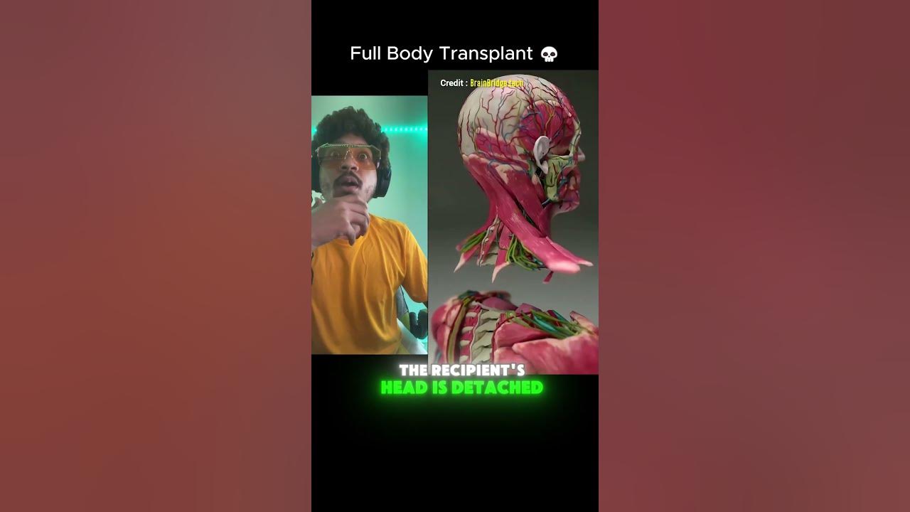 When you need a Full Body Transplant 💀 #body #transplant #surgeryday #ytviral #viral #shorts