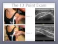 Don buford md 13 point shoulder ultrasound exam