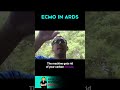54: ARDS Part 2... Meds, Proning, and ECMO With Guest Christian Guzman APRN