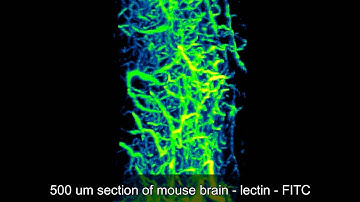 Visikol HISTO - Brain Vasculature