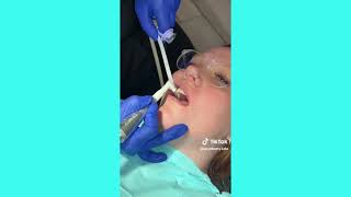 Polishing Techniques With Academy For Dental Istants