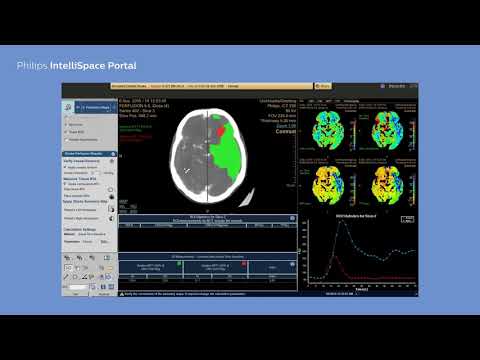 Philips IntelliSpace Portal  clinical application CT Brain Perfusion
