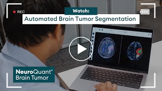 Automated Brain Tumor Segmentations | NeuroQuant Brain Tumor