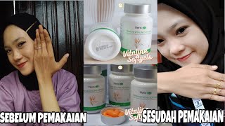 REVIEW PENGALAMAN MINUM VITALINE SOFTGELS TIENS PEMUTIH KULIT screenshot 5