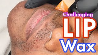 Waxing SUPER STRONG Mustache #Hirsutism #LipWax