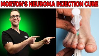 Mortons Neuroma Injection Cure? Neuroma Cortisone Injection