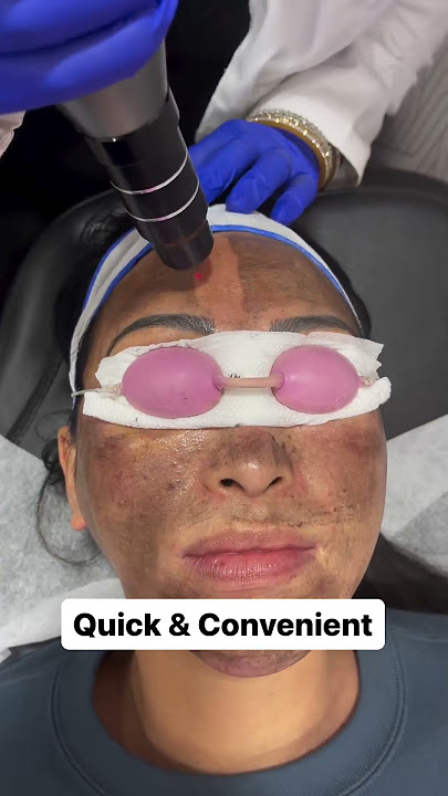 Q-Switched lasers a type of laser technology used in dermatology & cosmetic medicine | 9311691081 |