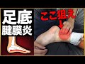 【9割の治療家が勘違い】足底腱膜炎をスパッと解決する黄金テクニックを公開!