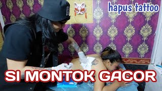 SI MONTOK GACOR || hapus tattoo