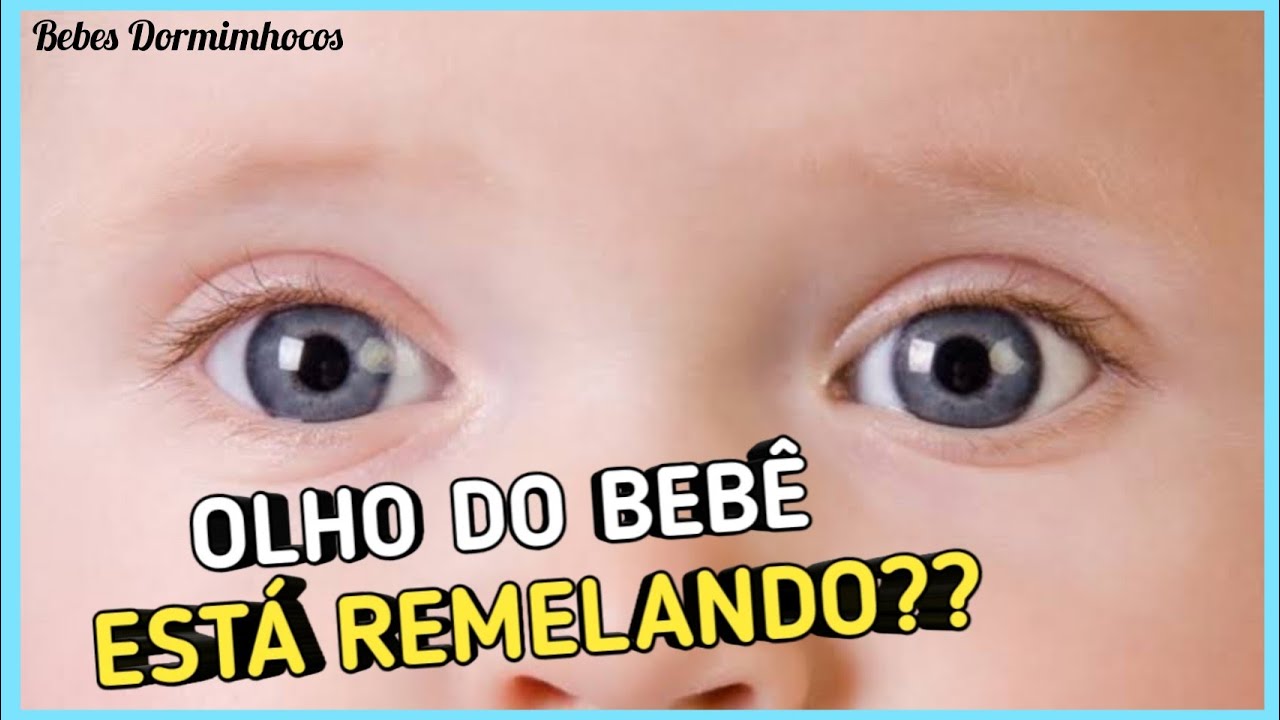 O QUE PODE SER OS OLHOS REMELANDO DO BEBÊ!! - YouTube