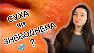 видео: СУХА та ЗНЕВОДНЕНА ШКІРА: різниця і догляд. картинка: СУХА та ЗНЕВОДНЕНА ШКІРА: різниця і догляд.
