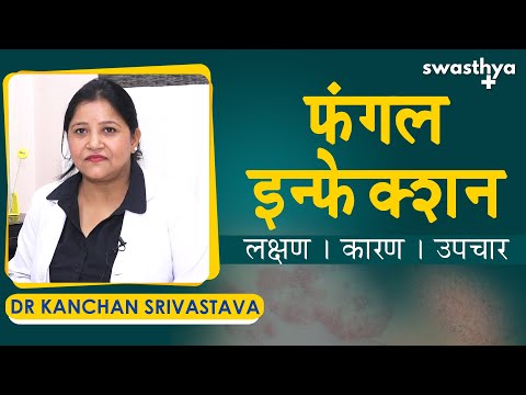 फंगल इन्फेक्शन - लक्षण, कारण, उपचार |Dr Kanchan Srivastava on Causes & Treatment of Fungal Infection
