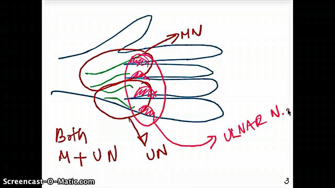 Muscles of the Hand and Median Nerve - YouTube