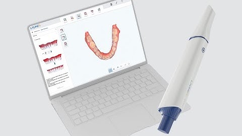 The New Launca DL-300 Series Intraoral Scanners