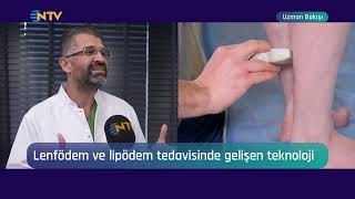 NTV Uzman Bakışı | Lenfödem ve Lipödem Nedir, Neden Oluşur? | Op. Dr. Orhan Rodoplu | 21 Kasım